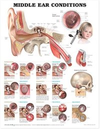 bokomslag Middle Ear Conditions Anatomical Chart
