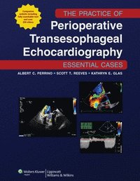 bokomslag The Practice of Perioperative Transesophageal Echocardiography: Essential Cases