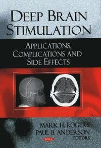 bokomslag Deep Brain Stimulation