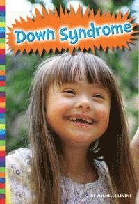 bokomslag Down Syndrome