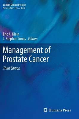 bokomslag Management of Prostate Cancer