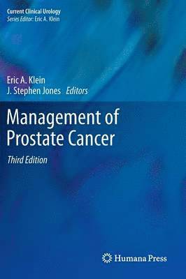 Management of Prostate Cancer 1
