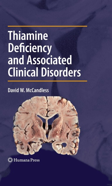 David W. McCandless - Thiamine Deficiency and Associated Clinical Disorders, Inbunden