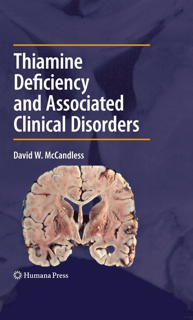 bokomslag Thiamine Deficiency and Associated Clinical Disorders