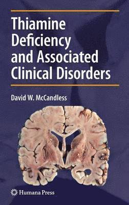 Thiamine Deficiency and Associated Clinical Disorders 1