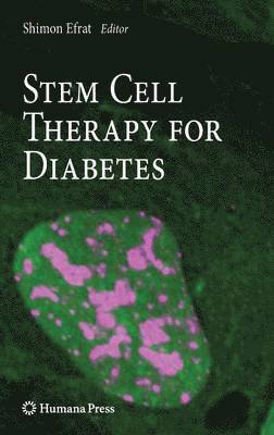 Stem Cell Therapy for Diabetes 1