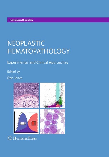 Dan Jones - Neoplastic Hematopathology, Inbunden