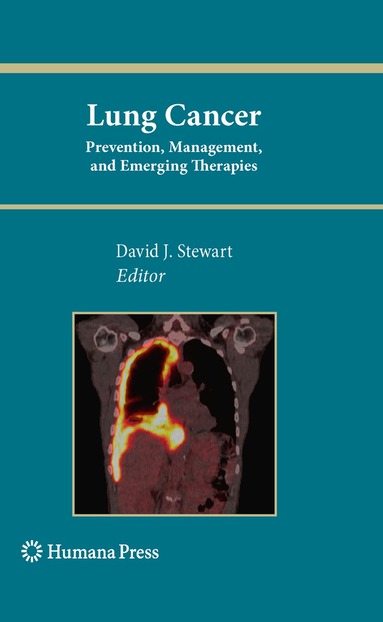 David J. Stewart - Lung Cancer:, Inbunden