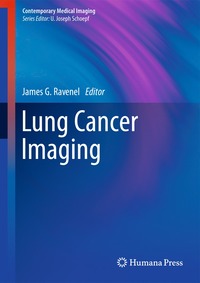 bokomslag Lung Cancer Imaging