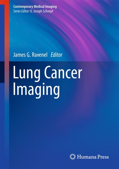 bokomslag Lung Cancer Imaging