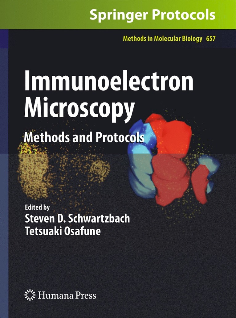 Immunoelectron Microscopy