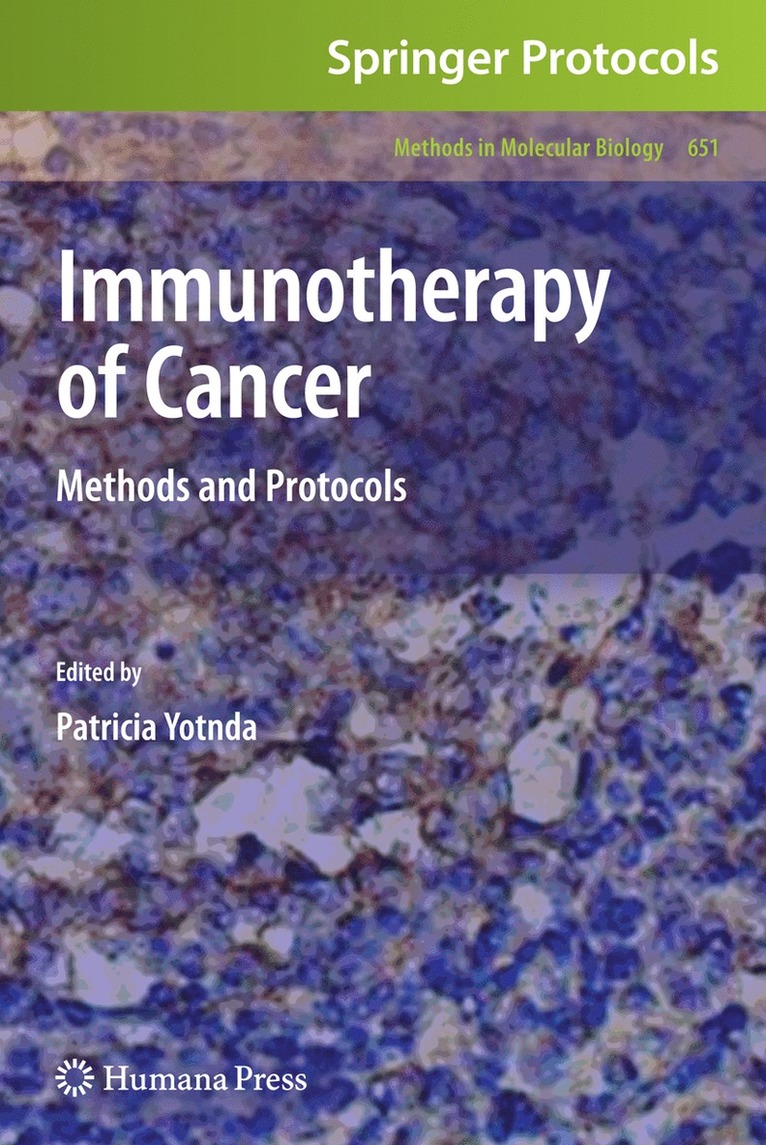 Patricia Yotnda - Immunotherapy of Cancer, Inbunden