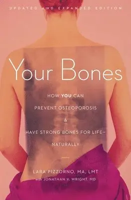 Lara Pizzorno - Your Bones: How You Can Prevent Osteoporosis and Have Strong Bones for Life--Naturally, Häftad. Tillgänglighet: Lägg i varukorg