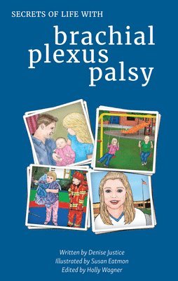Secrets of Life with Brachial Plexus Palsy 1