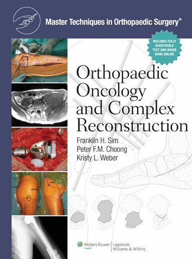 Franklin H. Sim, Peter F.M. Choong, Kristy L. Weber - Master Techniques in Orthopaedic Surgery: Orthopaedic Oncology and Complex Reconstruction, Inbunden