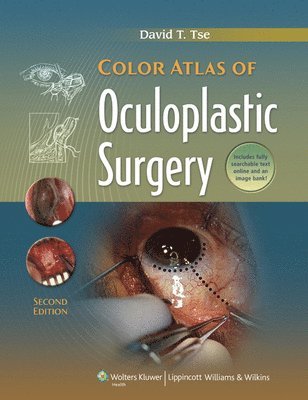 bokomslag Color Atlas of Oculoplastic Surgery