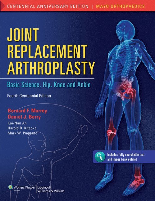 Kai-Nan An, Harold B. Kitaoka, Mark W. Pagnano - Joint Replacement Arthroplasty, Inbunden