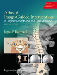 bokomslag Atlas of Image-Guided Intervention in Regional Anesthesia and Pain Medicine