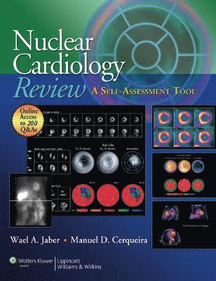 Nuclear Cardiology Review 1