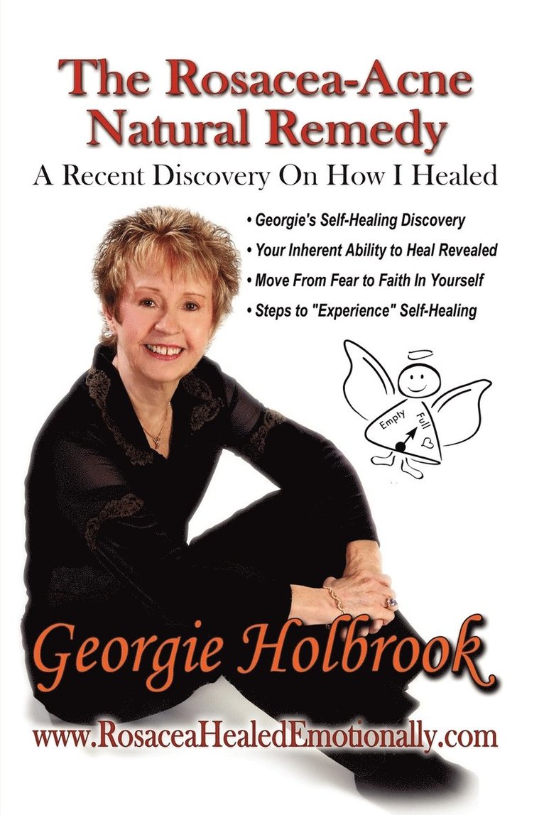 Georgie Holbrook - The Rosacea - Acne Natural Remedy, Häftad