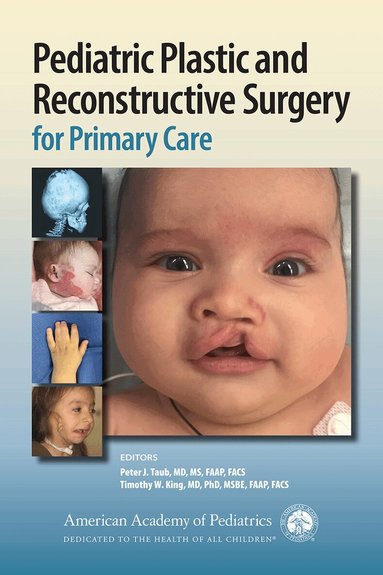 Peter J. Taub, Timothy W. King - Pediatric Plastic and Reconstructive Surgery for Primary Care, Häftad