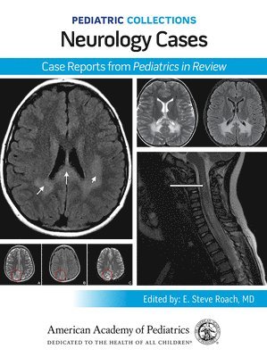 bokomslag Neurology Cases