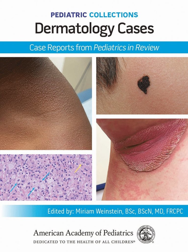 American Academy of Pediatrics - Dermatology Cases, Häftad