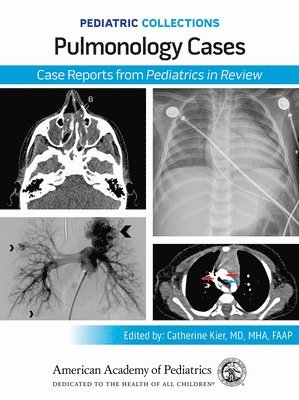 bokomslag Pediatric Collections: Pulmonology Cases: Case Reports from Pediatrics in Review