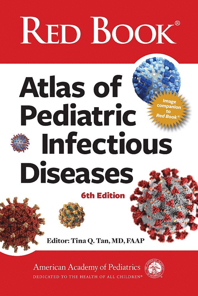 American Academy of Pediatrics AAP, American Academy of Pediatrics (Aap), Tina Q. Tan - Red Book Atlas of Pediatric Infectious Diseases, Inbunden