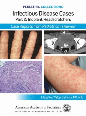 bokomslag Infectious Disease Cases: Part 2: Indolent Head Scratchers