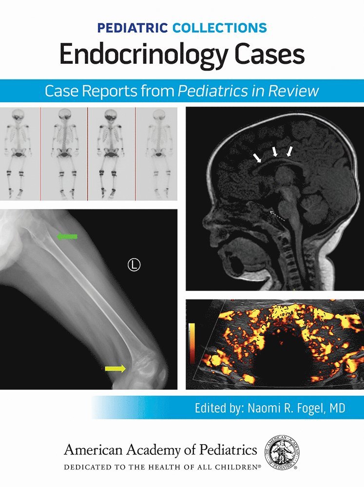 Endocrinology Cases