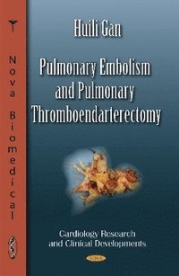 bokomslag Pulmonary Embolism & Pulmonary Thromboendarterectomy