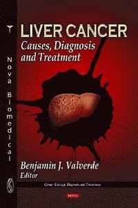 bokomslag Liver Cancer