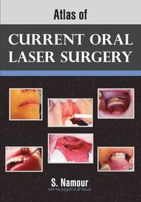 bokomslag Atlas of Current Oral Laser Surgery
