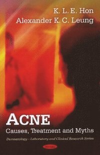 bokomslag Acne