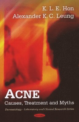bokomslag Acne