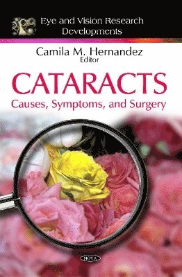 Cataracts 1