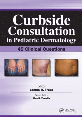 James Treat - Curbside Consultation in Pediatric Dermatology, Häftad