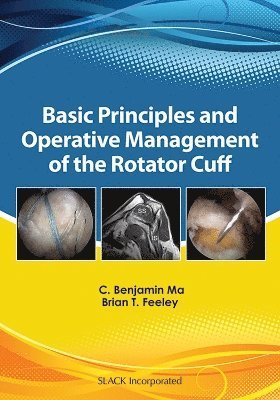 Benjamin C. Ma, Brian Feeley - Basic Principles and Operative Management of the Rotator Cuff, Inbunden