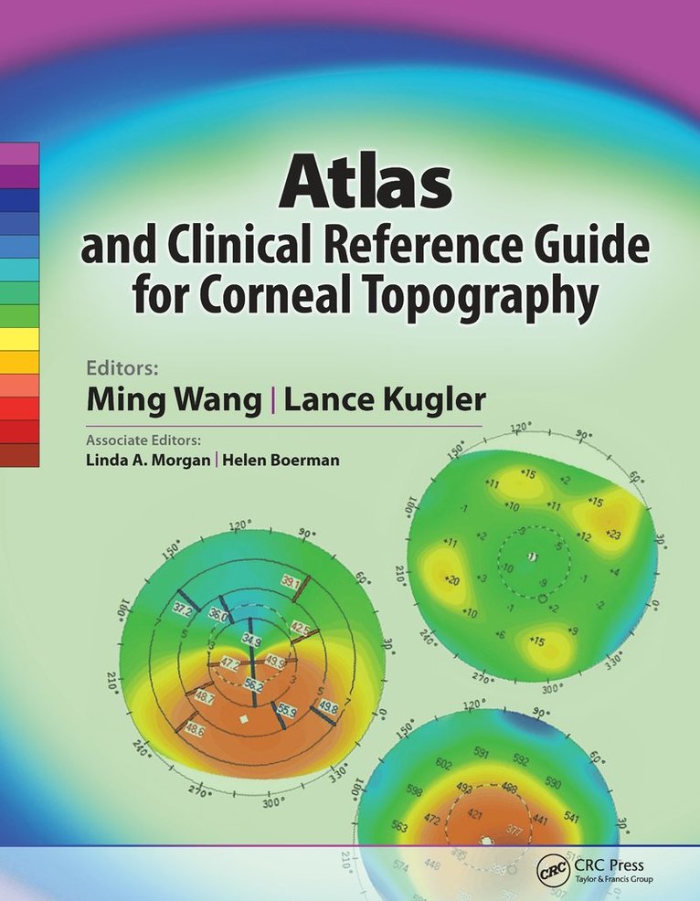 Ming Wang, Lance Kugler, Ph.D. Wang, Ming, M.D. - Atlas and Clinical Reference Guide for Corneal Topography, Häftad