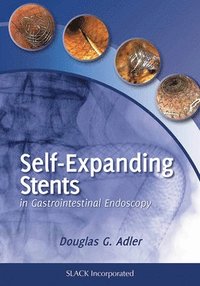 bokomslag Self-Expanding Stents in Gastrointestinal Endoscopy