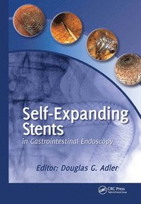 bokomslag Self-Expanding Stents in Gastrointestinal Endoscopy