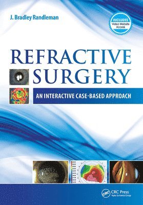 bokomslag Refractive Surgery