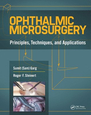 Ophthalmic Microsurgery 1