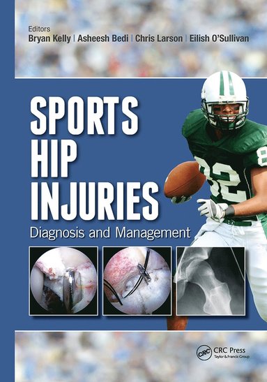 bokomslag Sports Hip Injuries