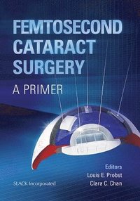 bokomslag Femtosecond Cataract Surgery