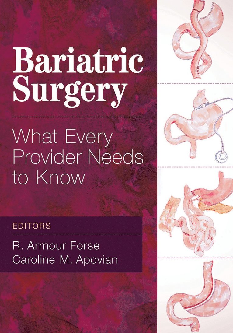 R. Armour Forse, Caroline Apovian - Bariatric Surgery, Häftad