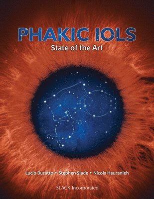 Phakic IOLs 1