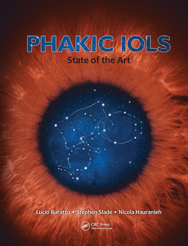 Phakic IOLs