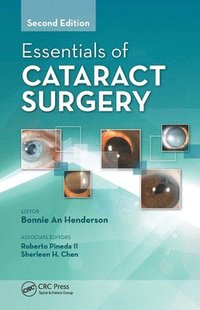 bokomslag Essentials of Cataract Surgery